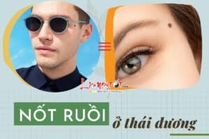 not ruoi o thai duong 1